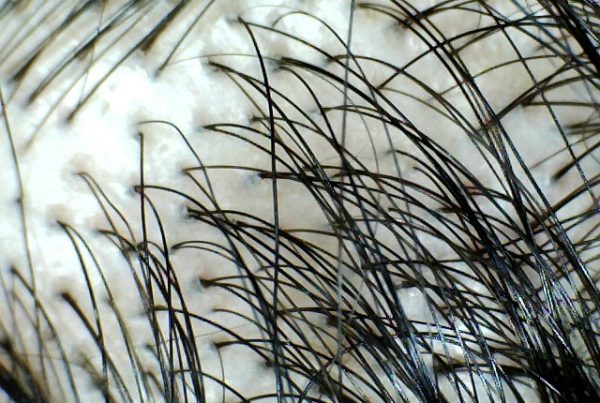 hair-close-up