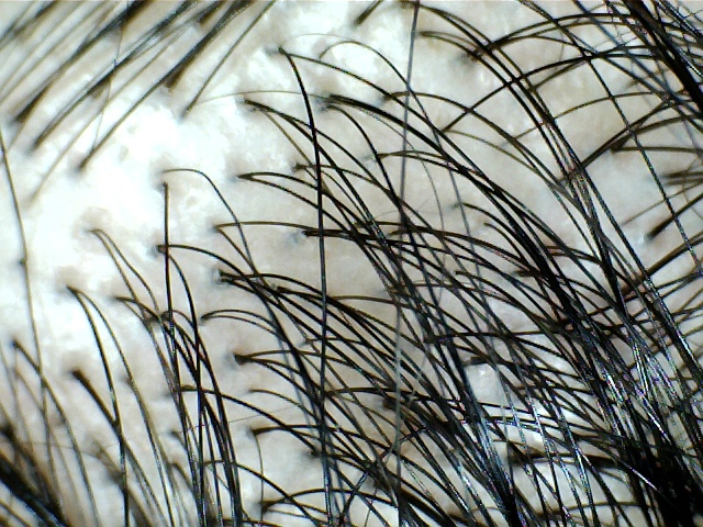 hair-close-up
