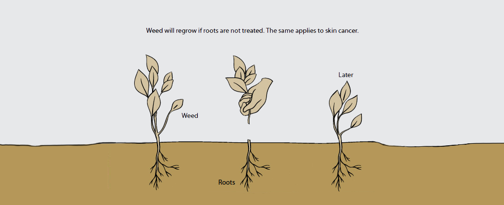 weeds-and-roots